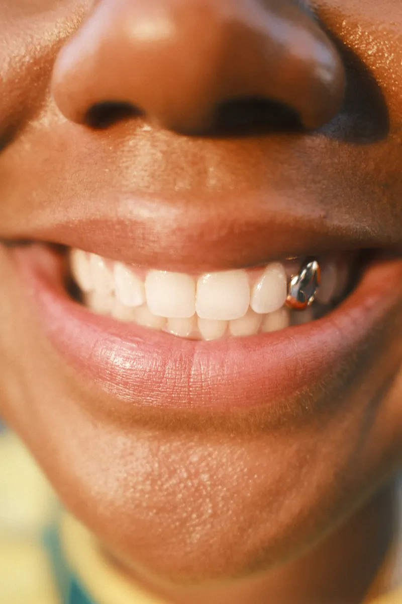 Close-up of a wide smile with a single gold grill